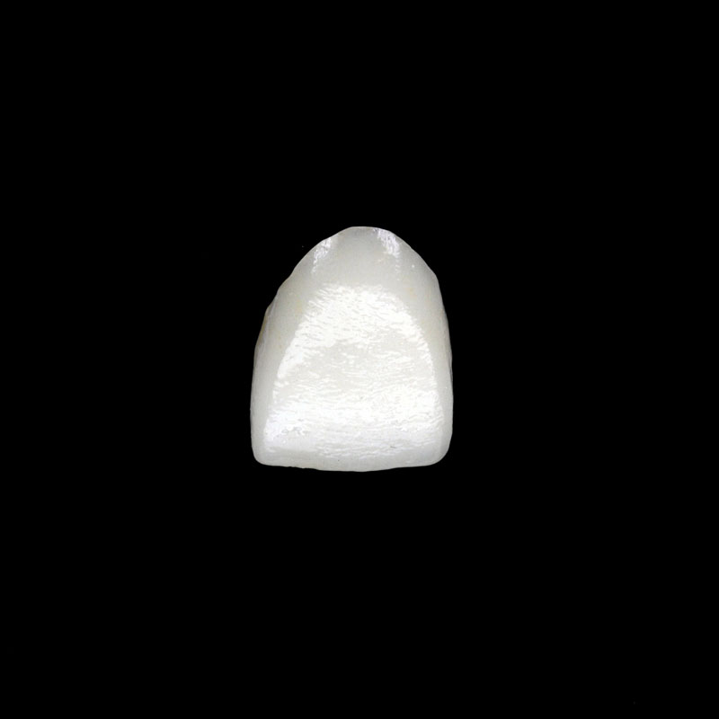 烤瓷类产品